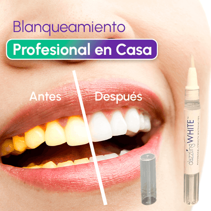 Lápiz Blanqueador Dental - DAZZLING WHITE + Envío GRATIS + Tratamiento durante 6 meses