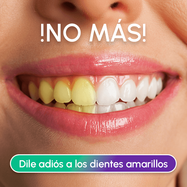Lápiz Blanqueador Dental - DAZZLING WHITE + Envío GRATIS + Tratamiento durante 6 meses